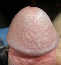 Fotografija povečanega penisa penisa