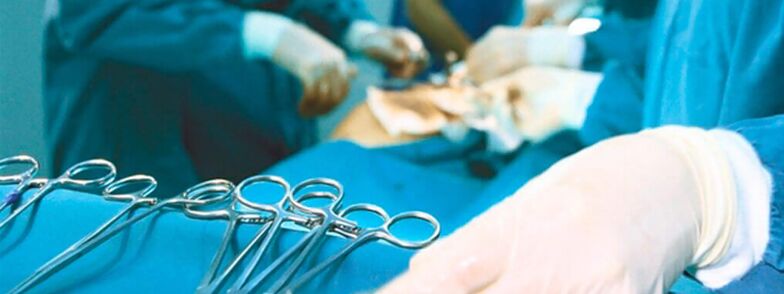 Operacija povečanja penisa, ki jo izvaja kirurg