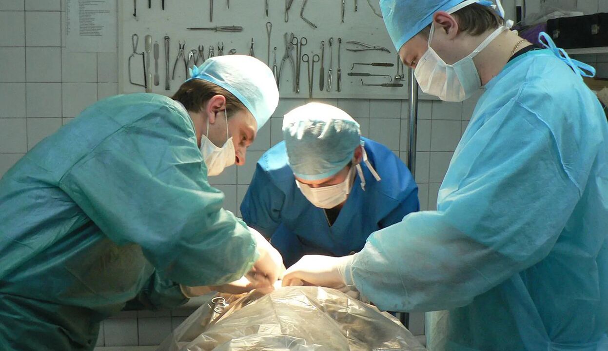 Kirurgija je drag način za povečanje penisa
